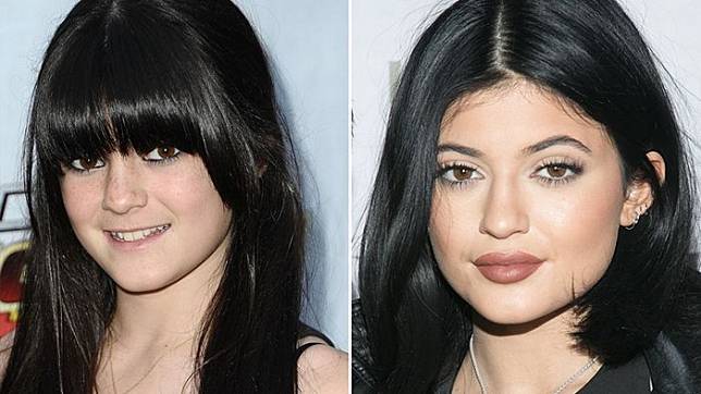 5 Perubahan Kylie Jenner dari Polos Hingga Oplas Sana Sini