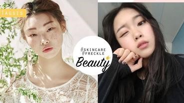 我們都離雀斑不遠了！不用破費做激光也能減淡斑斑，女生們加油啊～