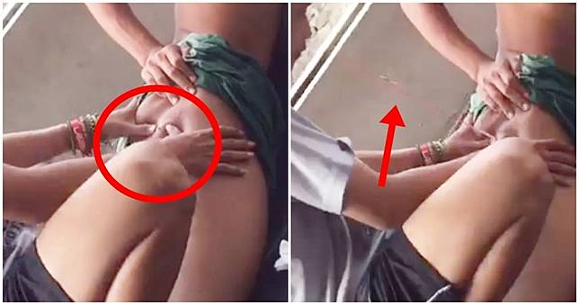 幫擠屁股痘痘！一壓噗哧炸裂「膿血噴射滿臉」　他濕身奔逃