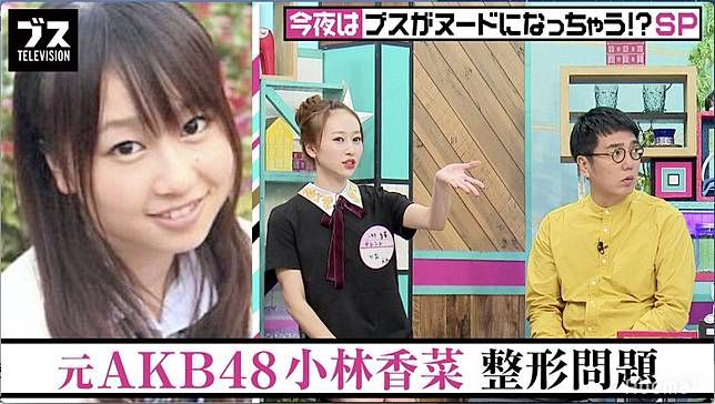 Akb48前成員小林香菜自爆8年整容逾10次 On Cc 東網 Line Today