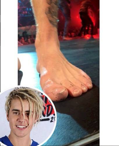 Iyuh, Kaki 13 Seleb Dunia Ini Nggak Semulus Wajahnya, Nomor 7 Paling Bikin Ilfeel!