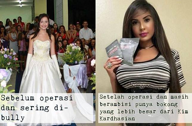 Demi Mengenang Kekasihnya, Model Ini Lakukan Operasi Plastik dan Habiskan Rp1,3 Miliar untuk Jadi Barbie yang Lebih 'Curvy'