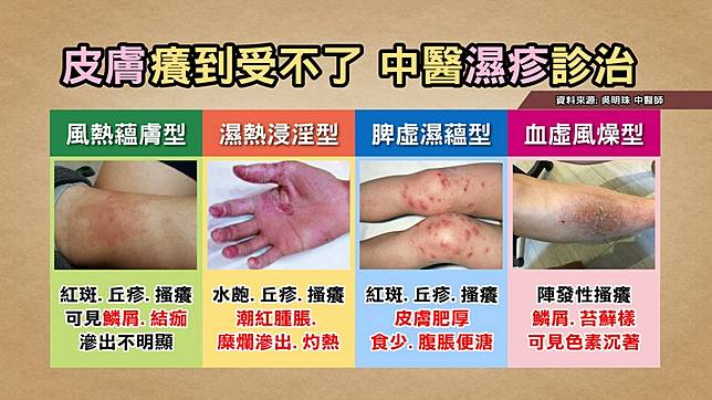 濕疹反覆好不了 當心是皮膚癌！慢性皮膚炎癢不停，中醫授「1茶飲」排毒止癢 | 健康2.0 | LINE TODAY