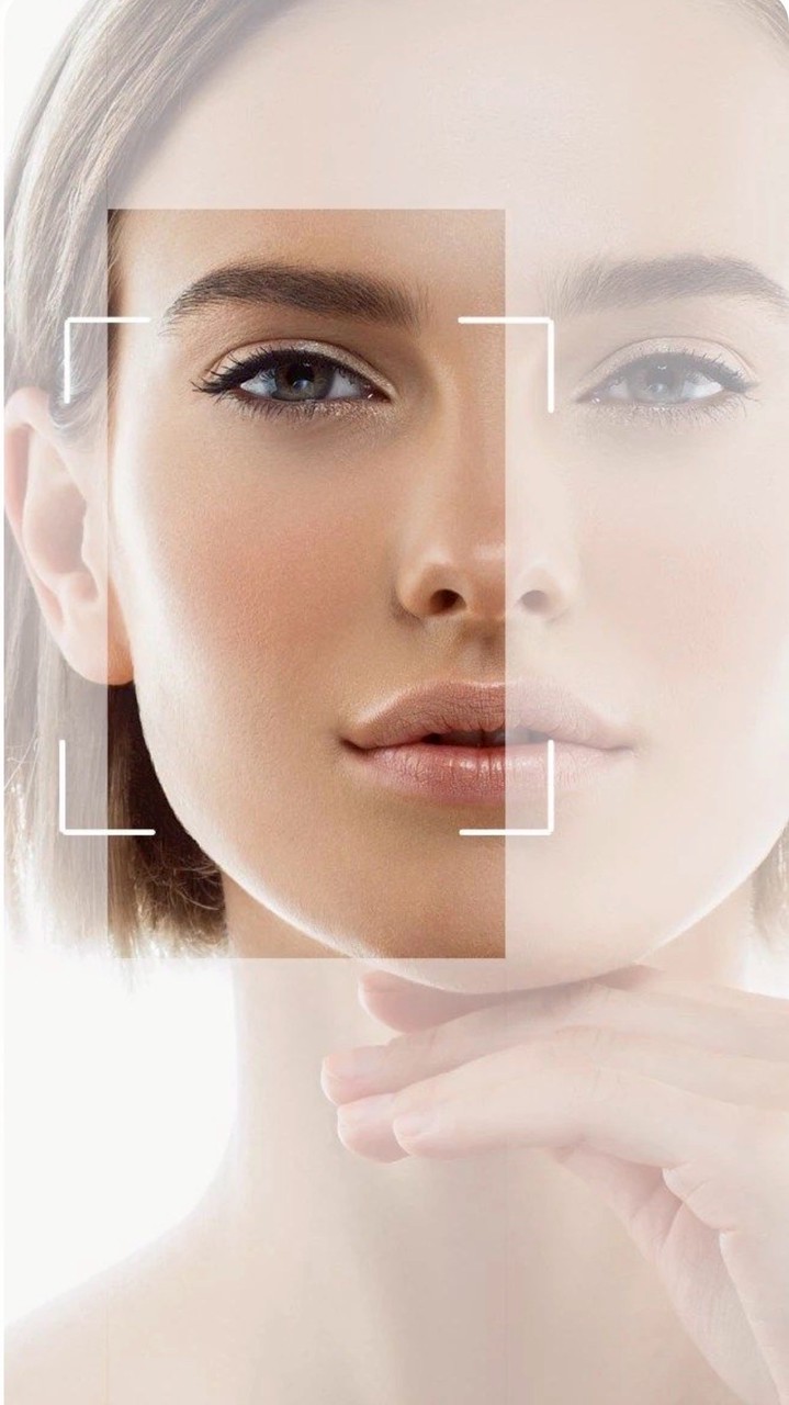 KD VDO ลูกค้า 69