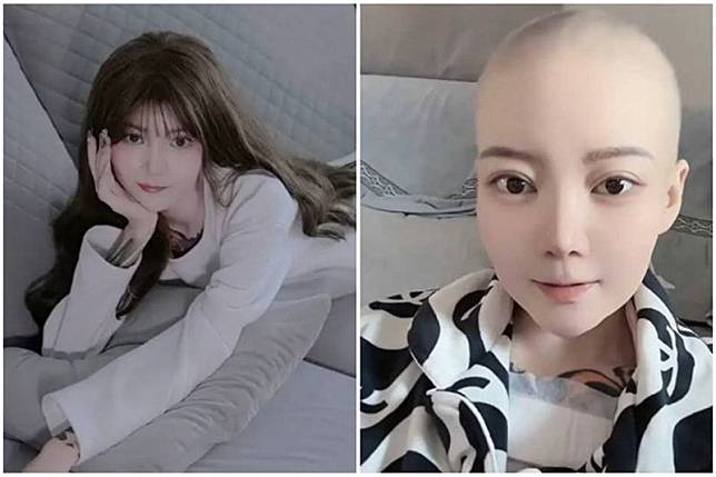 中國陝西省一名網紅「菲菲公主」驚傳20日癌逝，得年28歲。（翻攝自微博）