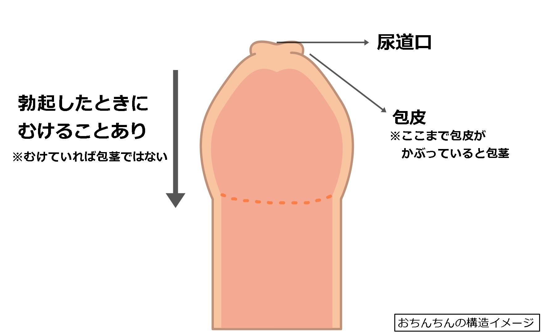 うちの子、むいたほうがいいの？」男の子の性器、むくorむかない問題 