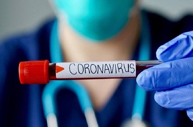 Viral di Medsos, 30 Karyawan Giant Reaktif Covid-19   