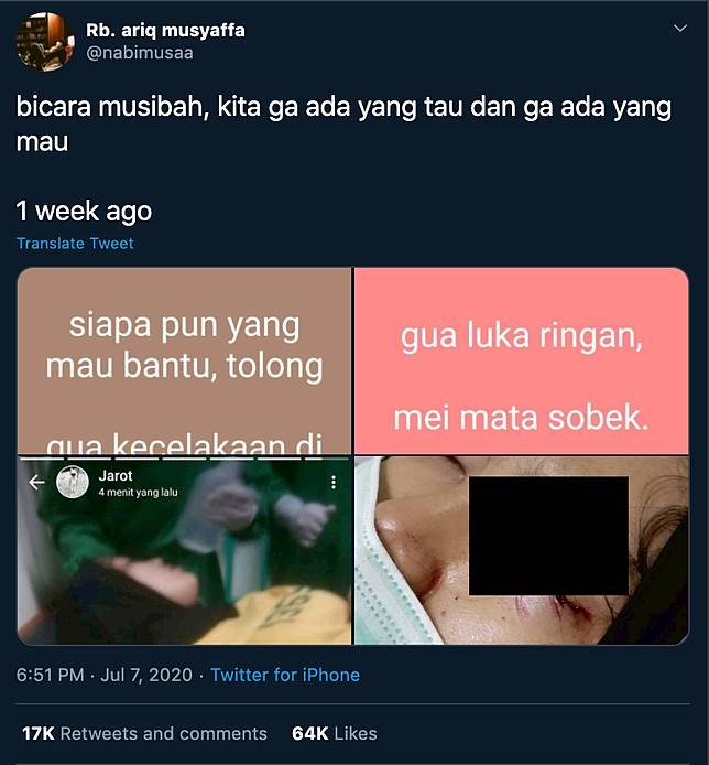 Kisah Ketegaran Pacar Yang Bola Matanya Diangkat karena Kecelakaan