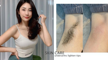 腋下黑黑超級糗？皮膚科醫生解析腋下黑原因，加碼腋下美白技巧推薦，腋下有感亮一階