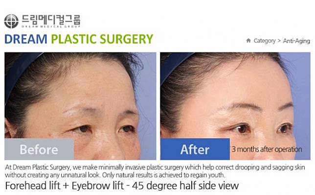 Dream Plastic Surgery