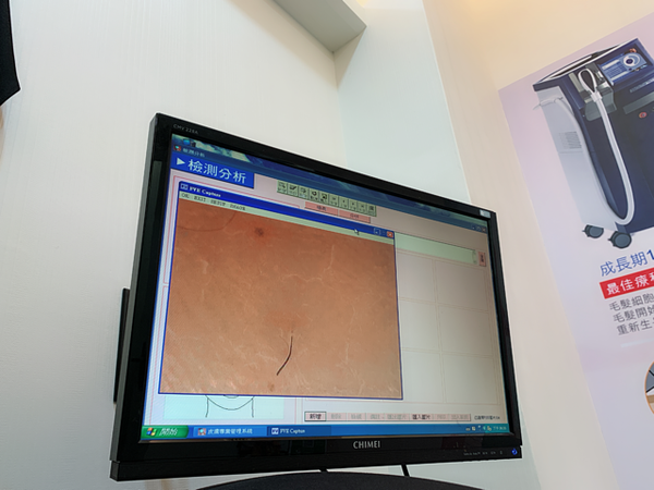 倪倪愛漂亮－『台中除毛推薦』女星名媛網紅安全可靠私密處VIO除毛與腳部除毛秘密基地-媄婧美學診所德國二極體光纖雷射與無痛真空除毛療程直擊分享，台中雷射除毛價格，除毛推薦，台中雷射除毛