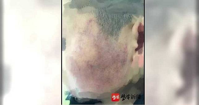 抓學生頭撞黑板遭調校！家長「蓋手印連署」求老師回來