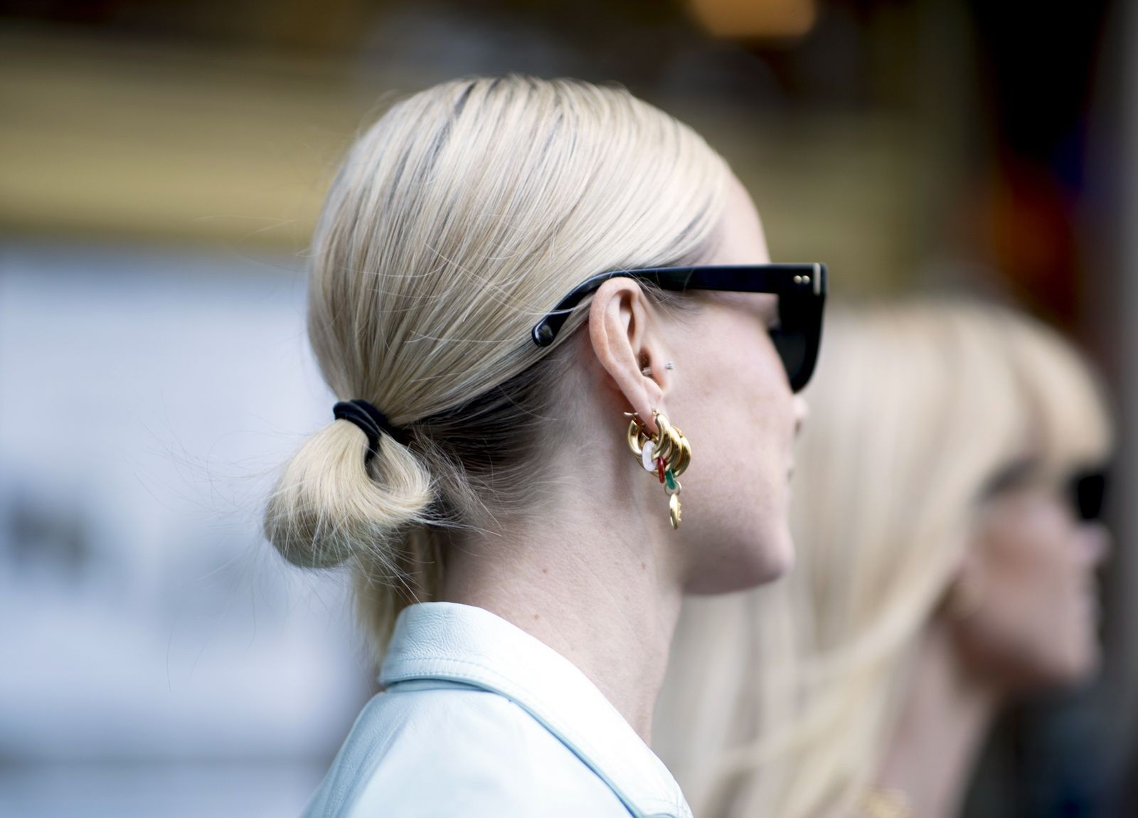 できると痛い頭皮ニキビの原因は 皮膚科医がすすめるケア法も公開