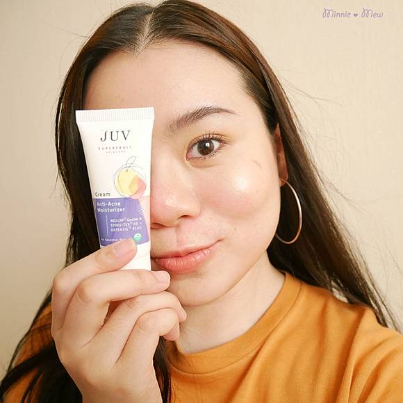 juv anti acne moisturizer