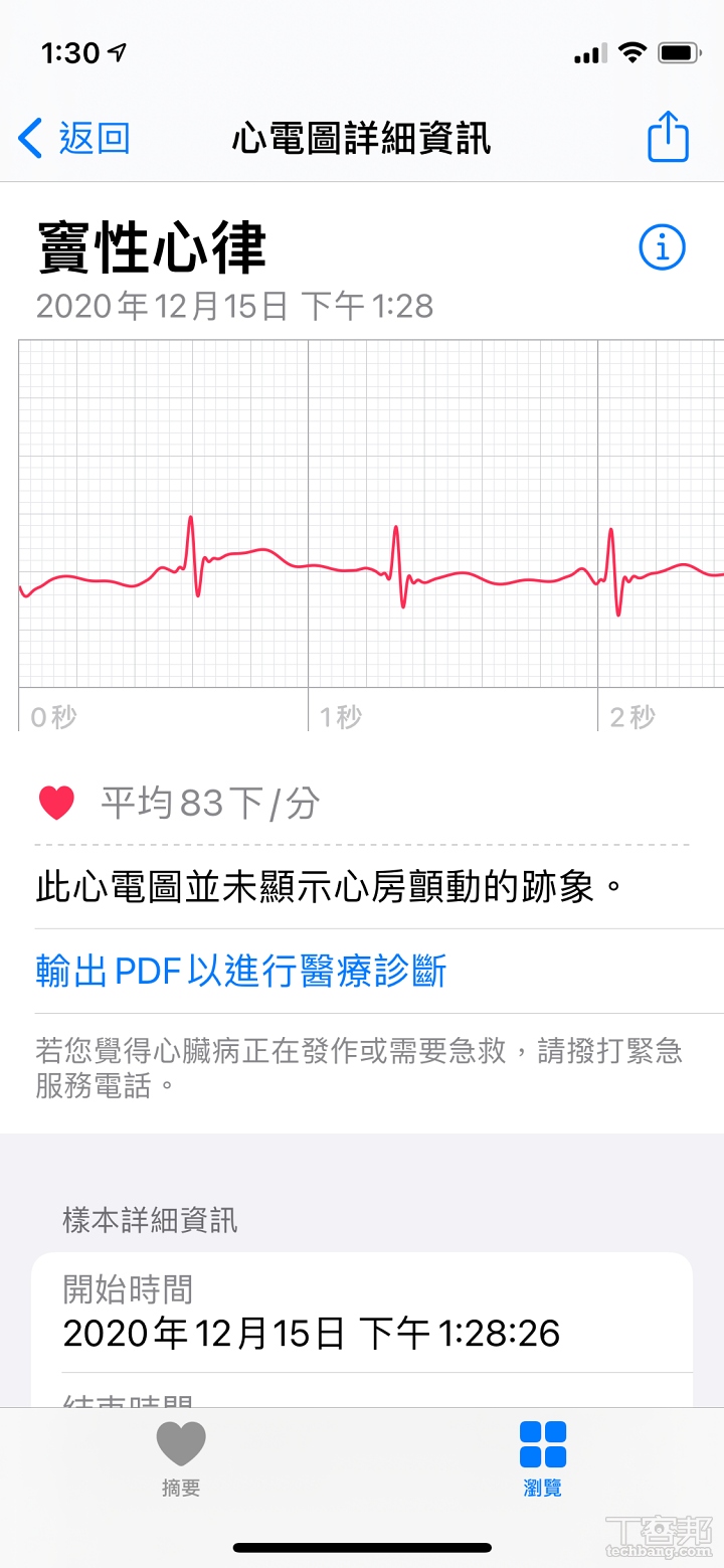 也可將心電圖輸出為 PDF 協助醫療判斷。