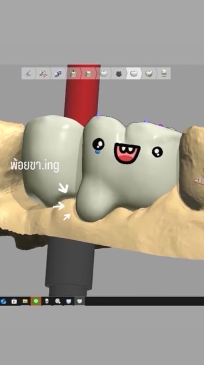 แลปฆ่าไม่ตาย