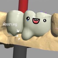แลปฆ่าไม่ตาย