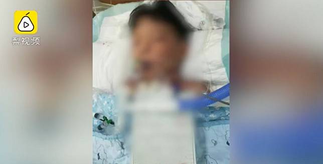 Chinese Boy 5 Who Swallowed Rat Poison At Kindergarten Unlikely
