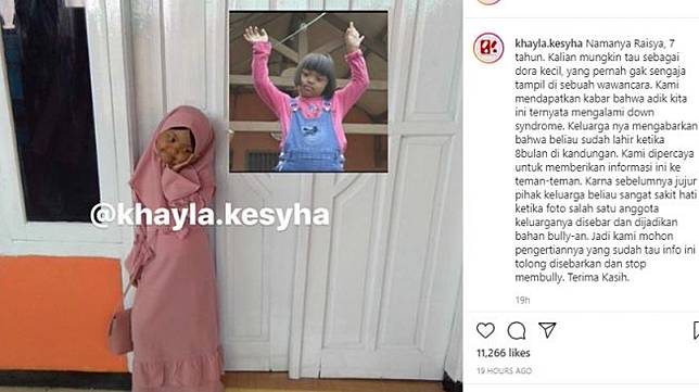Adik Ini Sering Dijadikan Meme Keluarga Keberatan Dan Ungkap Kondisinya Suara Com Line Today