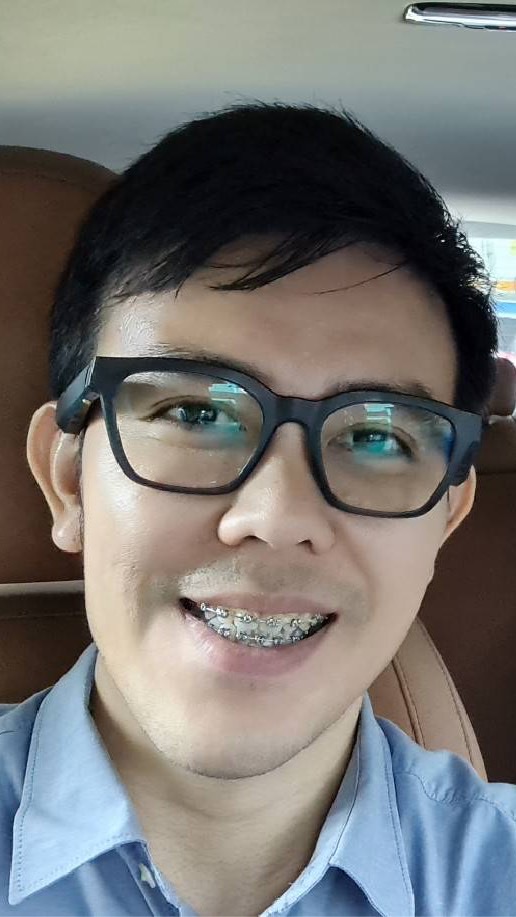รวมใจช่วยชง