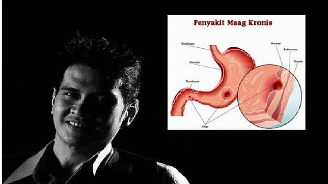 Terungkap Inilah Makanan Pemicu Maag Akut Dokter Ryan Thamrin Kamu