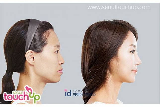 Seoul Touch Up