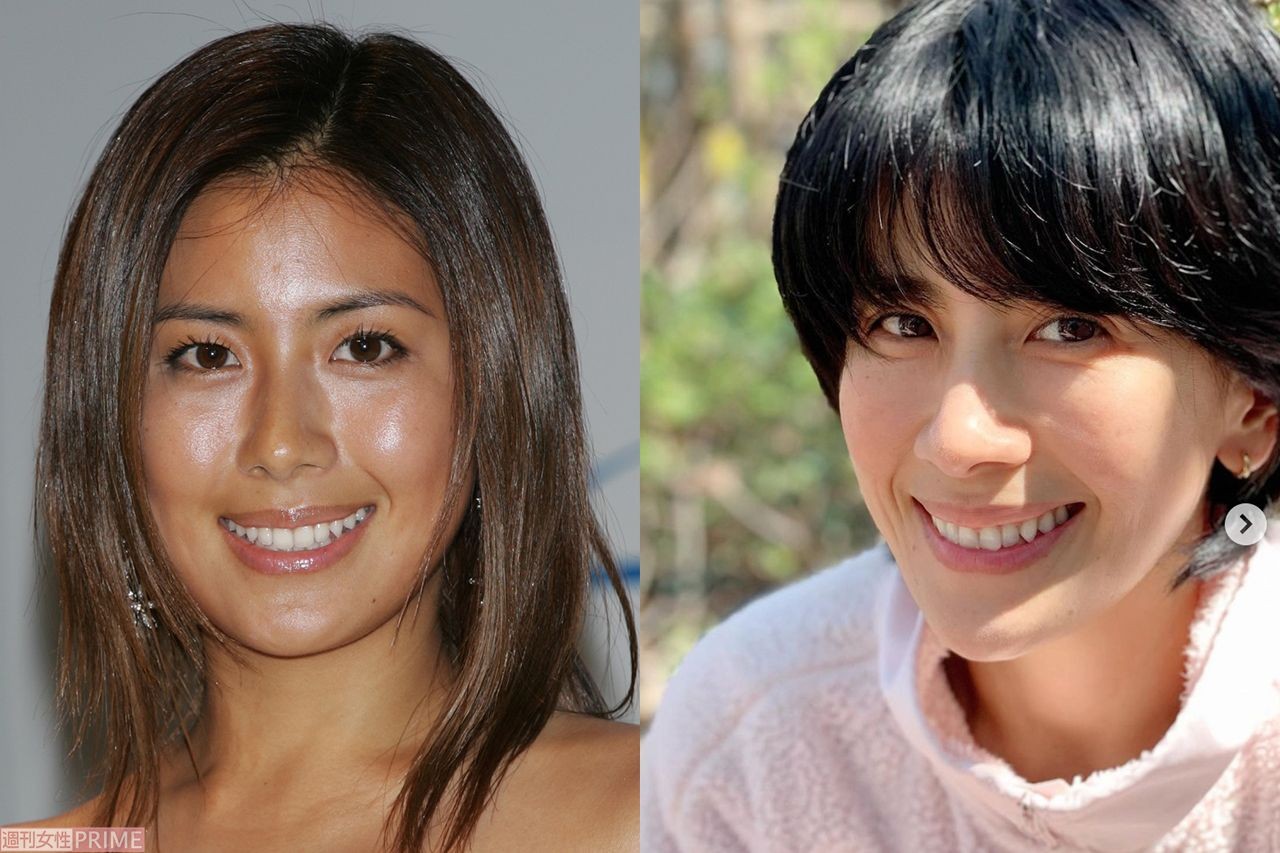 米倉涼子 藤原紀香 長谷川理恵 梨花の顔面変化を美容外科医が分析