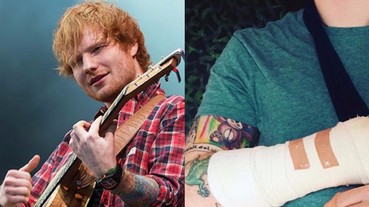 粉絲崩潰！紅髮艾德來台灣開唱前 居然摔傷了彈吉他的黃金右手！