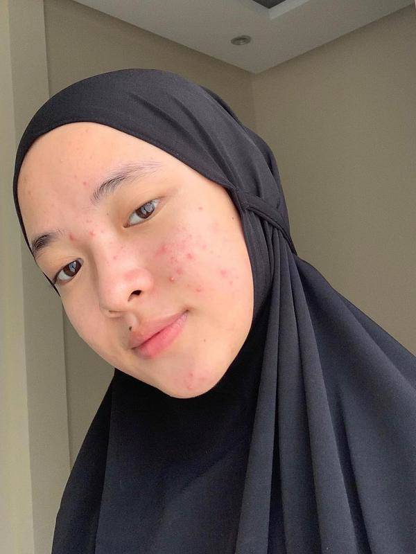 Unggah Foto Berjerawat, Ini 6 Potret Nissa Sabyan Tanpa Makeup