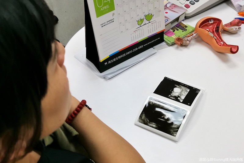 嘉義產檢x嘉安婦幼診所x4D高層次超音波檢查
