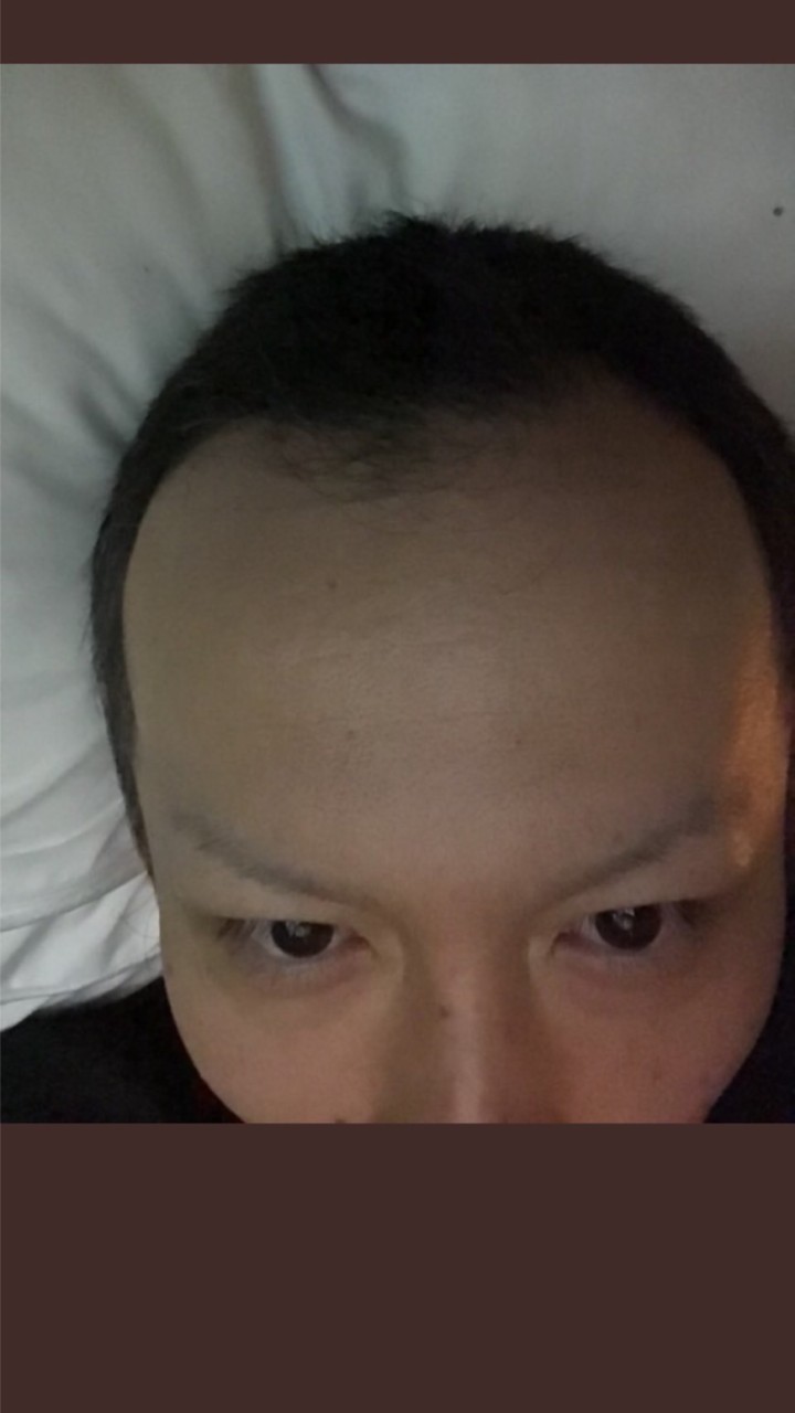 MU ムー アンチオプチャ
