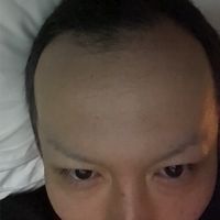 MU ムー アンチオプチャ