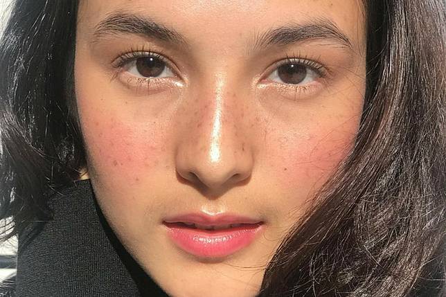 5 Artis Indonesia yang Berani Tampil Unik dengan Freckles