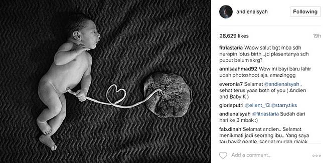 Pakai Lotus Birth, Andien Pamer Bayinya Tersambung Plasenta