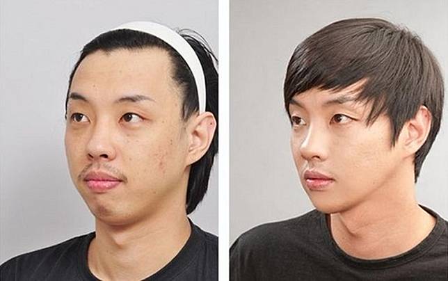 15 Foto Sebelum dan Sesudah Cowok Korea Oplas, Nyaris Mirip Oppa Boyband!