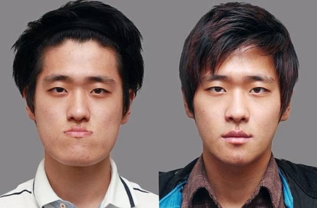 15 Foto Sebelum dan Sesudah Cowok Korea Oplas, Nyaris Mirip Oppa Boyband!