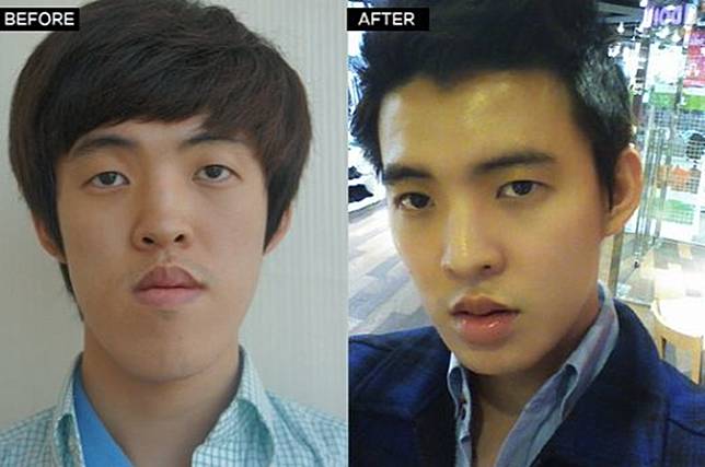 15 Foto Sebelum dan Sesudah Cowok Korea Oplas, Nyaris Mirip Oppa Boyband!