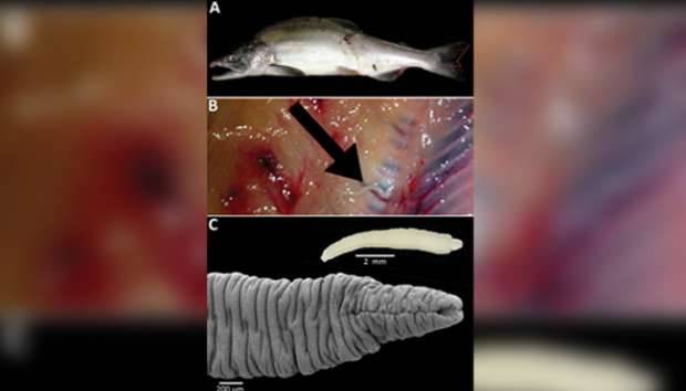  Salmon Amerika Terinfeksi Cacing Pita Jepang 