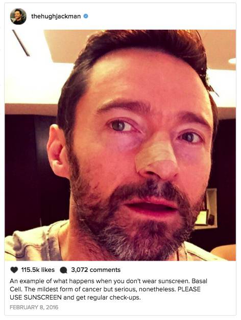 Kembali Didiagnosis Kanker Kulit, Hugh Jackman Ingatkan Pentingnya Tabir Surya