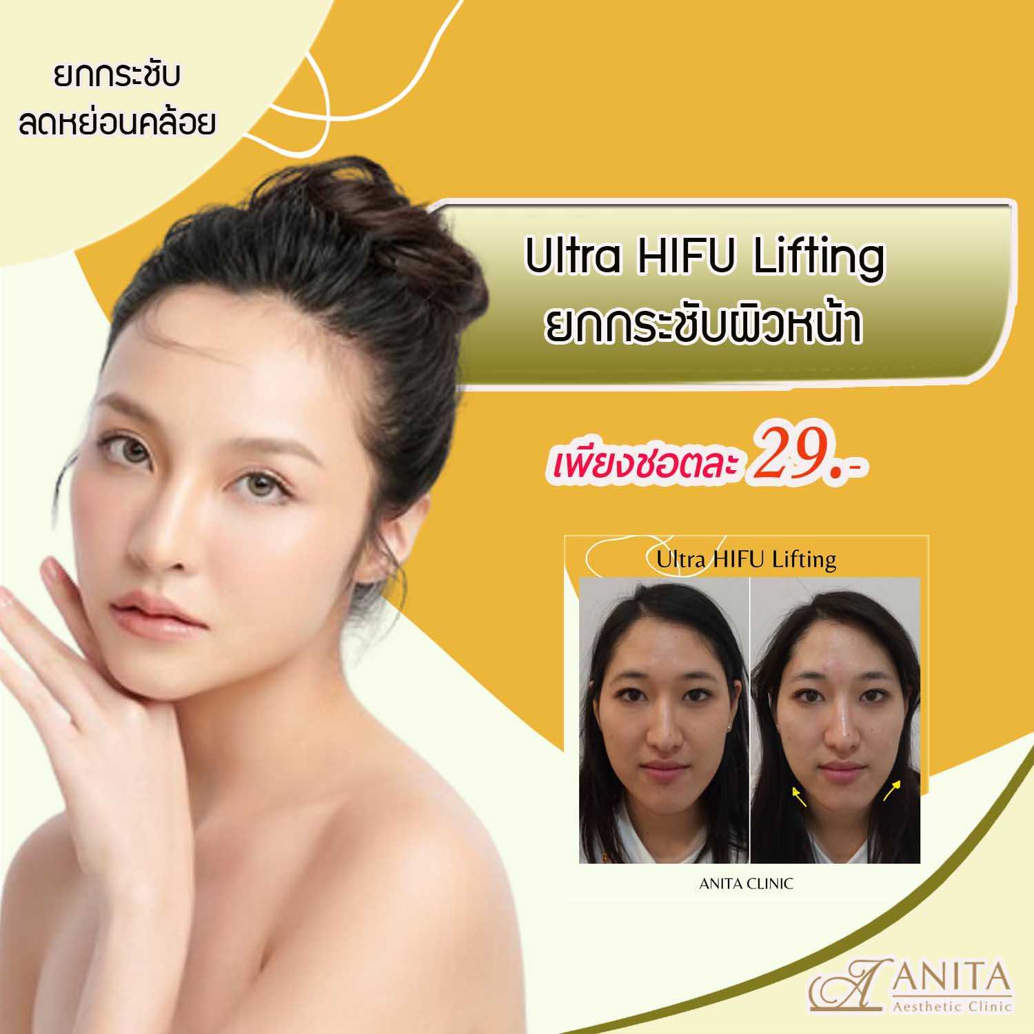 Ultra HIFU Lifting เพียง ชอตละ 29.- | LINE SHOPPING
