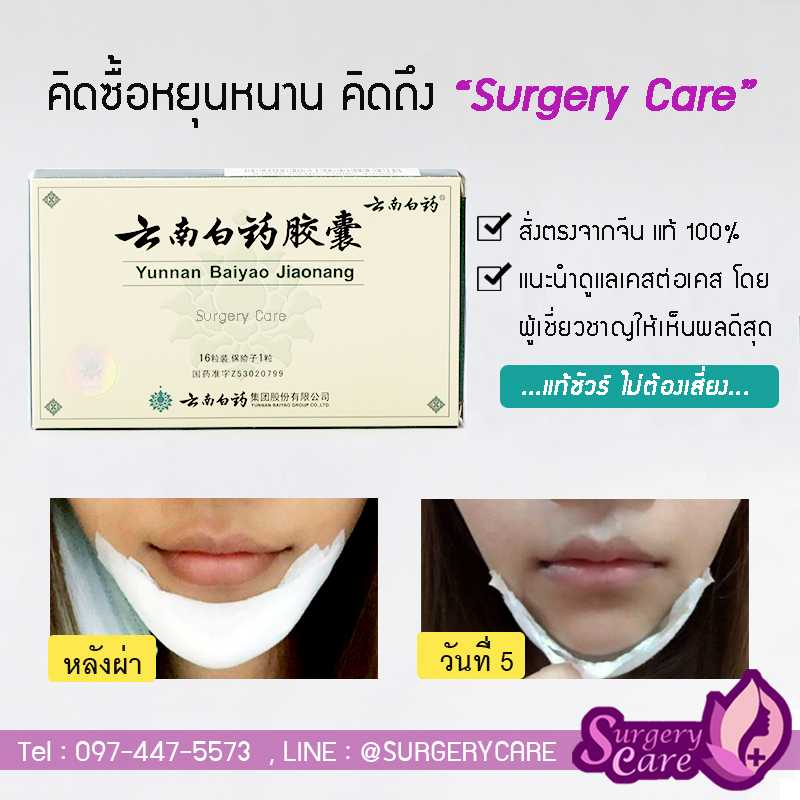 ขายหยุนหนานไป๋เหยา เขียว(Yunnan Baiyao) หยุนหนานไป่เหยาแท้ พร้อมส่ง ลด ...