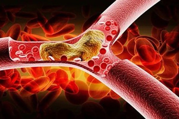  HIV予防のための注射が臨床研究で有望な結果を示す