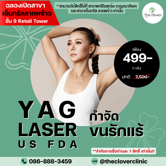 YAG LASER ขนรักแร้ 499-จำกัดการซื้อท่านละ 1 สิทธิ์ เท่านั้น!!