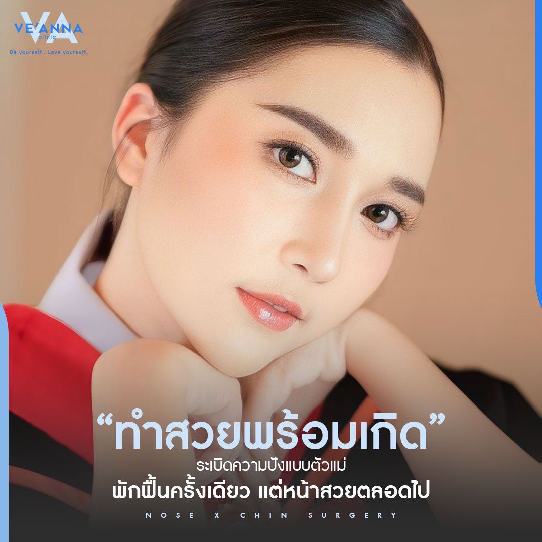 คางสวย จมูกปัง